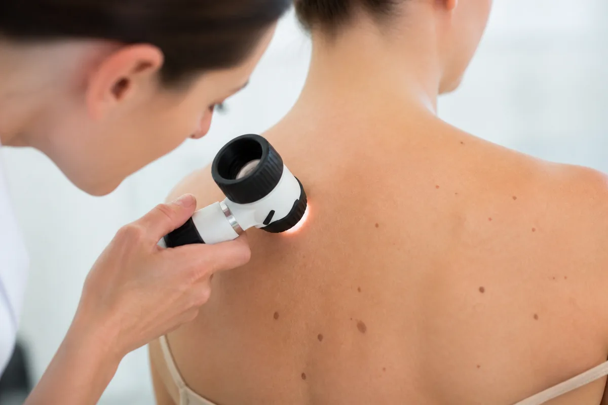 Dermatoscopy Skin Screening